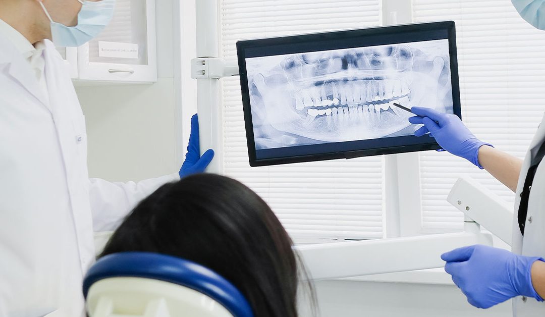 How Long Does A Root Canal Take?