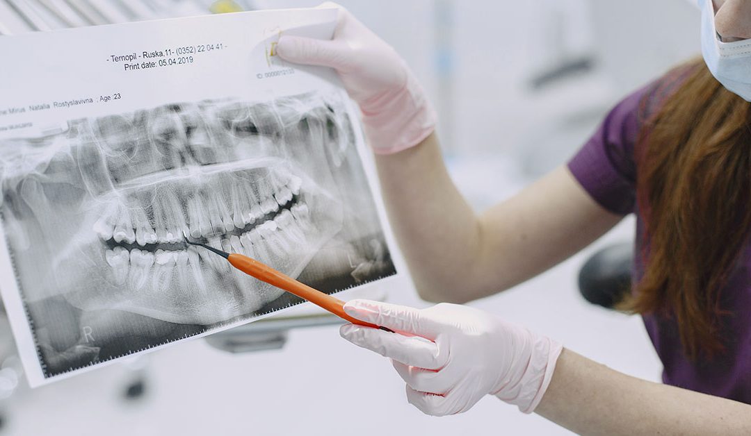 Wisdom Tooth Pain: Symptoms, Treatment and Relief